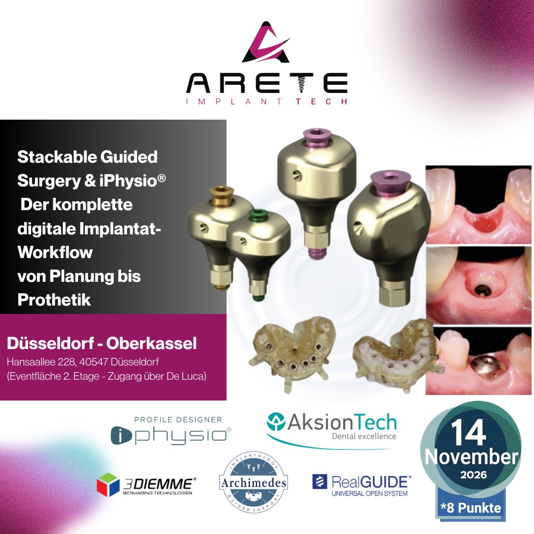 Stackable Guided Surgery & iPhysio®: The Complete Digital Implant Workflow, from Planning to Prosthetics